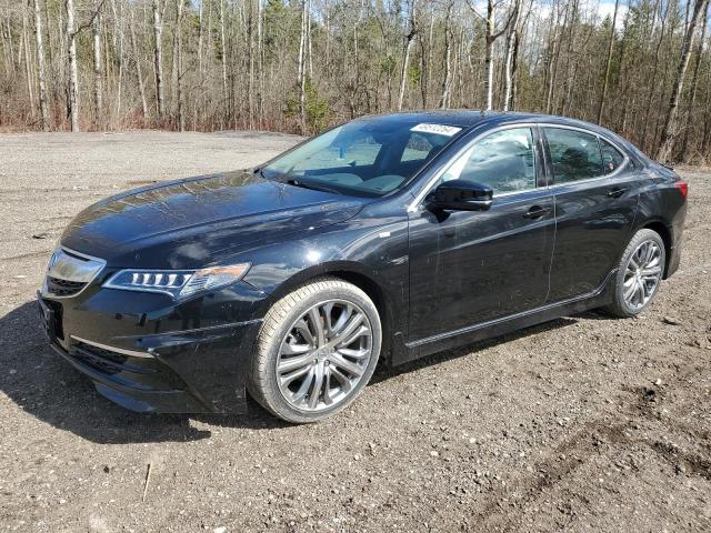 2017 ACURA TLX TECH, 