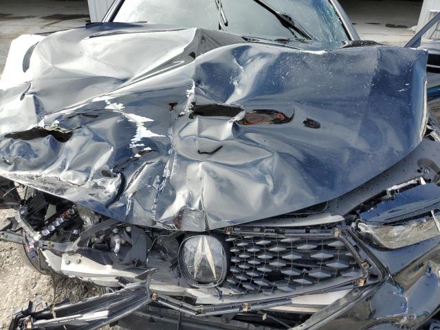 19UUB2F68KA008459 - 2019 ACURA TLX TECHNOLOGY BLACK photo 11