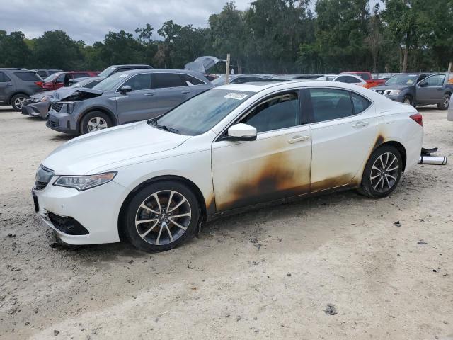 2017 ACURA TLX ADVANCE, 